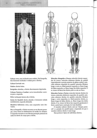 Cabeça: ereta, nem inclinada nem rodada. (Na fotografia,
discretamente inclinada e rodada para a direita).
Coluna Cervical: reta.
Ombro: direito baixo.
Escápulas: aduzidas, a direita discretamente deprimida.
Colunas Torácica e Lombar: curva toracolombar conve-
xa para a esquerda.
Pelve: inclinação lateral, alta à direita.
Juntas do Quadril: direita aduzida e levemente rodada
medialmente; esquerda abduzida.
Membros Inferiores: retos, nem arqueados nem des-
viados.
Pés: na fotografia, o direito encontra-se em discreta prona-
ção, como vemos no alinhamento do tendão do calcâneo.
O esquerdo encontra-se em discreta pronação postural em
razão do desvio do corpo para a direita.
Músculos Alongados e Fracos: músculos laterais esquer-
dos do tronco, músculos abdutores direitos do quadril
(especialmente a porção posterior do glúteo médio), mús-
culos adutores esquerdos do quadril, músculos fibulares
longo e curto, m. tibial posterior esquerdo, m. flexor longo
do hálux esquerdo, m. flexor longo dos dedos esquerdo. O
m. tensor da fáscia lata direito pode ou não ser fraco.
Músculos Curtos e Fortes: músculos laterais direitos do
tronco, músculos abdutores esquerdos do quadril, mús-
culos adutores direitos do quadril, músculos fibulares
longo e curto esquerdos, m. tibial posterior direito, m.
flexor longo do hálux direito, m. flexor longo dos dedos
direito. O m. tensor da fáscia lata esquerdo geralmente é
forte e pode haver contração do trato iliotibial.
O membro inferior direito está em "adução postu-
ra!'~ e a posição do quadril passa a impressão de que o
membro inferior direito é mais longo. ..
Essa postura é típica de indivíduos destros.
 