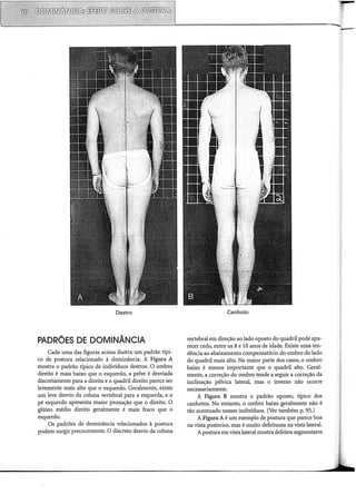 Destro
PADRÕES DE DOMINÂNCIA
Cada uma das figuras acima ilustra um padrão típi-
co de postura relacionado à dominância. A Figura A
mostra o padrão típico de indivíduos destros. O ombro
direito é mais baixo que o esquerdo, a pelve é desviada
discretamente para a direita e o quadril direito parece ser
levemente mais alto que o esquerdo. Geralmente, existe
um leve desvio da coluna vertebral para a esquerda, e o
pé esquerdo apresenta maior pronação que o direito. O
glúteo médio direito geralmente é mais fraco que o
esquerdo.
Os padrões de dominância relacionados à postura
podem surgir precocemente. O discreto desvio da coluna
Canhoto
vertebral em direção ao lado oposto do quadril pode apa-
recer cedo, entre os 8 e 10 anos de idade. Existe uma ten-
dência ao abaixamento compensatório do ombro do lado
do quadril mais alto. Na maior parte dos casos, o ombro
baixo é menos importante que o quadril alto. Geral-
mente, a correção do ombro tende a seguir a correção da
inclinação pélvica lateral, mas o inverso não ocorre
necessariamente.
A Figura B mostra o padrão oposto, típico dos
canhotos. No entanto, o ombro baixo geralmente não é
tão acentuado nesses indivíduos. (Ver também p. 95.)
A Figura A é um exemplo de postura que parece boa
na vista posterior, mas é muito defeituosa na vista lateral.
Apostura em vista lateral mostra defeitos segmentares
 