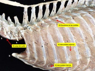 M.intercostales externos
M.intercostales internos
M.Elevadores de las costillas
M.Largo del cuello
 