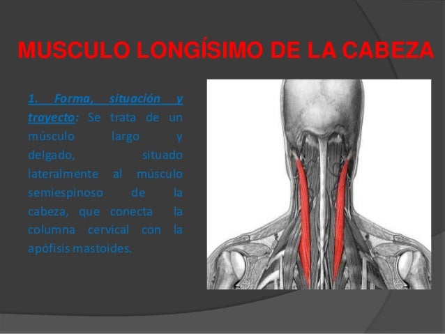 Que untar al dolor en el cuello