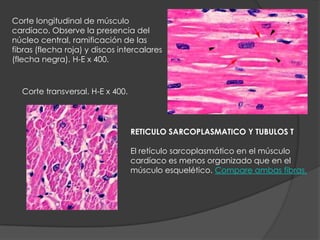 Corte transversal. H-E x 400.
RETICULO SARCOPLASMATICO Y TUBULOS T
El retículo sarcoplasmático en el músculo
cardíaco es menos organizado que en el
músculo esquelético. Compare ambas fibras.
Corte longitudinal de músculo
cardíaco. Observe la presencia del
núcleo central, ramificación de las
fibras (flecha roja) y discos intercalares
(flecha negra). H-E x 400.
 