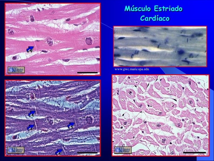 As Celulas Do Tecido Muscular Sao Ricas Em Proteinas