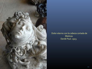 Dolor eterno con la cabeza cortada de
Medusa.
Dardé Paul. 1913..
65
 