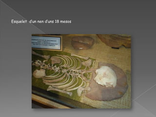 Esquelet d’un nen d’uns 18 mesos
 