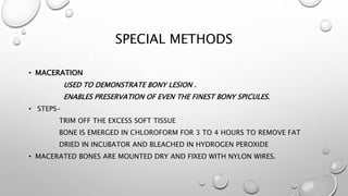 SPECIAL METHODS
• MACERATION
USED TO DEMONSTRATE BONY LESION .
ENABLES PRESERVATION OF EVEN THE FINEST BONY SPICULES.
• ST...