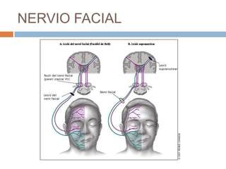 NERVIO FACIAL
 
