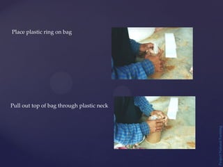 Project
Natural
Farming
Place plastic ring on bag
Pull out top of bag through plastic neck
 