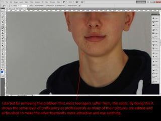 I started by removing the problem that most teenagers suffer from, the spots. By doing this it
shows the same level of proficiency as professionals as many of their pictures are edited and
airbrushed to make the advertisements more attractive and eye catching.
 