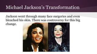 Michael Jackson’s Transformation
Jackson went through many face surgeries and even
bleached his skin. There was controversy for this big
change.
 