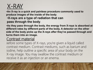 X-RAY
•An X-ray is a quick and painless procedure commonly used to
produce images of the inside of the body.
•X-rays are a type of radiation that can
pass through the body.
•As they pass through the body, the energy from X-rays is absorbed at
different rates by different parts of the body. A detector on the other
side of the body picks up the X-rays after they've passed through and
turns them into an image.
Contrast material
Before some types of X-rays, you're given a liquid called
contrast medium. Contrast mediums, such as barium and
iodine, help outline a specific area of your body on the
X-ray image. You may swallow the contrast medium or
receive it as an injection or an enema.
 