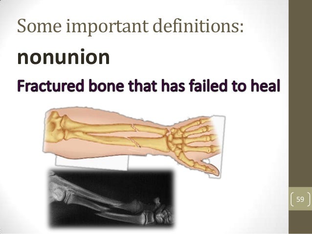 Muskloskeletal icd10