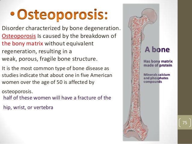 Muskloskeletal icd10 Muskloskeletal icd10