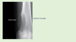 Codmann Triangle Muskuloskeletal Imaging modalities .pptx