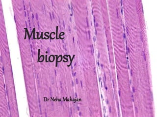 Muscle 
biopsy 
Dr Neha Mahajan 
 