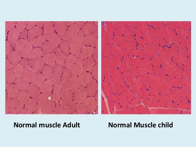 musle biopsy musle biopsy, Muscles