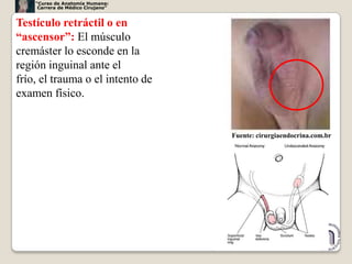 “Curso de Anatomía Humana:
     Carrera de Médico Cirujano”


Testículo retráctil o en
“ascensor”: El músculo
cremáster lo esconde en la
región inguinal ante el
frío, el trauma o el intento de
examen físico.


                                   Fuente: cirurgiaendocrina.com.br




                                                                  48
 