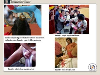 “Curso de Anatomía Humana:
       Carrera de Médico Cirujano”




                                                  Fuente: blogs.abcdesevilla.es
Las lesiones del paquete femoral son frecuentes
en los toreros. Fuente: star-21.blogspot.com




   Fuente: photoshop-designs.com                  Fuente: mundotoro.com           55
 