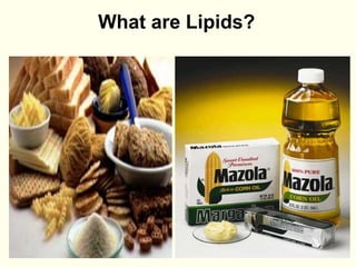 What are Lipids?
 