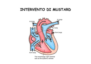 INTERVENTO DI MUSTARD
 