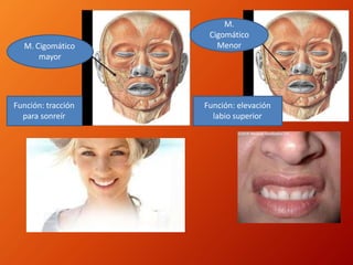 M. Cigomático
mayor
Función: tracción
para sonreír
M.
Cigomático
Menor
Función: elevación
labio superior
 