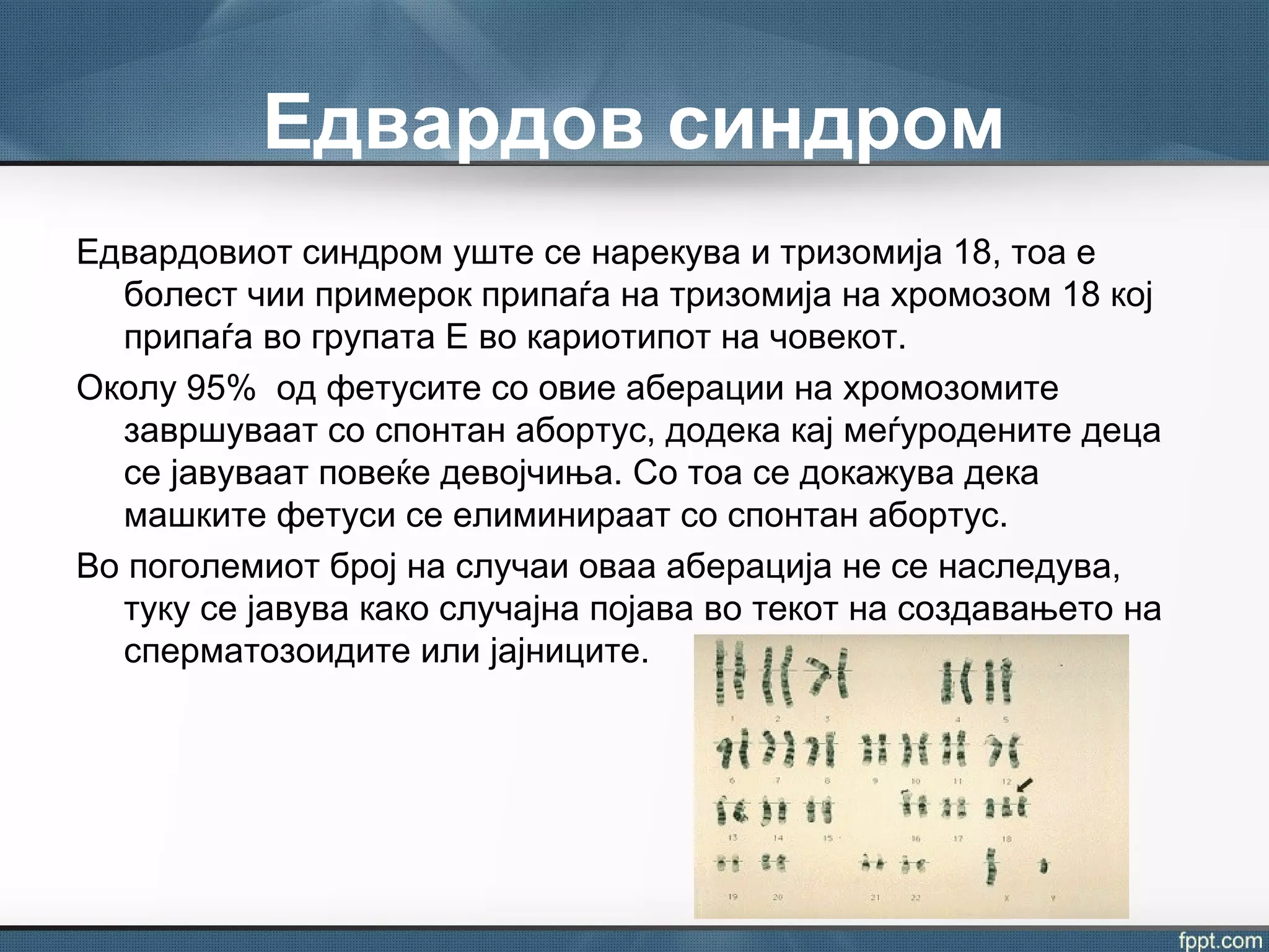 Едвардов синдром
Едвардовиот синдром уште се нарекува и тризомија 18, тоа е
болест чии примерок припаѓа на тризомија на хромозом 18 кој
припаѓа во групата Е во кариотипот на човекот.
Околу 95% од фетусите со овие аберации на хромозомите
завршуваат со спонтан абортус, додека кај меѓуродените деца
се јавуваат повеќе девојчиња. Со тоа се докажува дека
машките фетуси се елиминираат со спонтан абортус.
Во поголемиот број на случаи оваа аберација не се наследува,
туку се јавува како случајна појава во текот на создавањето на
сперматозоидите или јајниците.
 