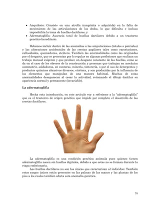 Adermatoglifia: Una mutación genética que impide la formación de ...