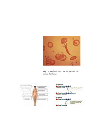 MUTACIONES GÉNICAS Y CROMOSÓMICAS