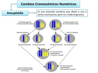 Cambios Cromosómicos Numéricos
Aneuploidía Es una anomalía numérica que afecta a uno o
varios cromosomas, pero no a todo el genoma.
 