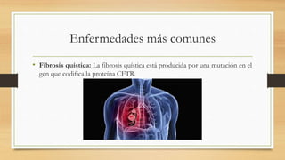 Enfermedades más comunes
• Fibrosis quística: La fibrosis quística está producida por una mutación en el
gen que codifica la proteína CFTR.
 