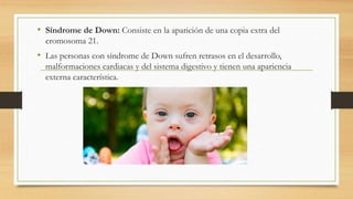 • Síndrome de Down: Consiste en la aparición de una copia extra del
cromosoma 21.
• Las personas con síndrome de Down sufren retrasos en el desarrollo,
malformaciones cardiacas y del sistema digestivo y tienen una apariencia
externa característica.
 