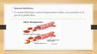• Anemia falciforme
• La anemia falciforme o anemia drepanocítica se debe a una mutación en el
gen de la globina Beta.
 