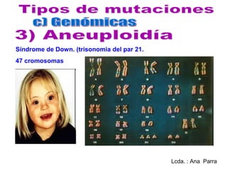Síndrome de Down. (trisonomia del par 21.
47 cromosomas




                                            Lcda. : Ana Parra
 