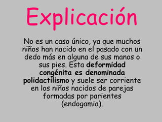 ExplicaciónNo es un caso único, ya que muchos niños han nacido en el pasado con un dedo más en alguna de sus manos o sus pies. Esta deformidad congénita es denominada polidactilismo y suele ser corriente en los niños nacidos de parejas formadas por parientes (endogamia).