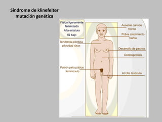 Síndrome de klinefeltermutación genética