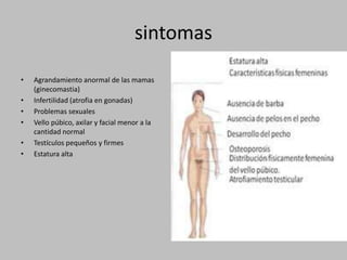 sintomasAgrandamiento anormal de las mamas (ginecomastia)Infertilidad (atrofia en gonadas)Problemas sexualesVello púbico, axilar y facial menor a la cantidad normalTestículos pequeños y firmesEstatura alta