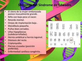 Síntomas del Síndrome de Edwadrs.
• El útero de la mujer embarazada
parece inusualmente grande.
• Niño con bajo peso al nacer.
• Retardo mental.
• Orejas de implantación baja .
• Mandíbula pequeña.
• Puños bien cerrados.
• Uñas hipoplásicas
(subdesarrolladas).
• Hernia umbilical o hernia inguinal.
• Diástasis del recto.
• Criptorquidia.
• Piernas cruzadas (posición
preferida).
• Enfermedad cardíaca congénita .
 