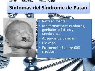 Síntomas del Síndrome de Patau
• Retraso mental.
• Malformaciones cardíacas,
genitales, dáctiles y
cerebrales.
• Ausencia de paladar.
• Pie vago.
• Frecuencia: 1 entre 600
nacidos.
 