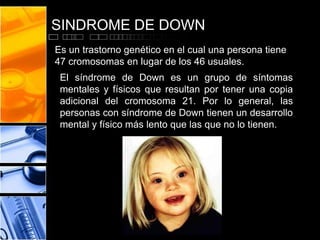 SINDROME DE DOWN
Es un trastorno genético en el cual una persona tiene
47 cromosomas en lugar de los 46 usuales.

El síndrome de Down es un grupo de síntomas
mentales y físicos que resultan por tener una copia
adicional del cromosoma 21. Por lo general, las
personas con síndrome de Down tienen un desarrollo
mental y físico más lento que las que no lo tienen.

 