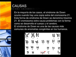 CAUSAS
En la mayoría de los casos, el síndrome de Down
ocurre cuando hay una copia extra del cromosoma 21.
Esta forma de síndrome de Down se denomina trisomía
21. El cromosoma extra causa problemas con la forma
como se desarrolla el cuerpo y el cerebro.
El síndrome de Down es una de las causas más
comunes de anomalías congénitas en los humanos.

 