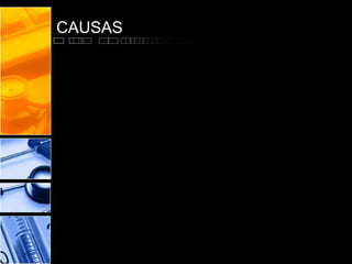 CAUSAS

 