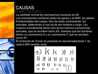 CAUSAS
La cantidad normal de cromosomas humanos es 46.
Los cromosomas contienen todos los genes y el ADN, los pilares
fundamentales del cuerpo. Dos de estos cromosomas, los
sexuales, determinan si uno ha de ser hombre o mujer. Las
mujeres normalmente tienen dos de los mismos cromosomas
sexuales, que se escriben como XX, mientras que los hombres
tienen un cromosoma X y un cromosoma Y, que se escriben
como XY.
El síndrome de Turner se presenta en aproximadamente 1 de
cada 2,000 nacidos vivos.

 