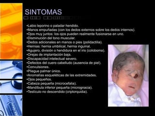 SINTOMAS
•Labio leporino o paladar hendido.
•Manos empuñadas (con los dedos externos sobre los dedos internos).
•Ojos muy juntos: los ojos pueden realmente fusionarse en uno.
•Disminución del tono muscular.
•Dedos adicionales en manos o pies (polidactilia).
•Hernias: hernia umbilical, hernia inguinal.
•Agujero, división o hendidura en el iris (coloboma).
•Orejas de implantación baja.
•Discapacidad intelectual severo.
•Defectos del cuero cabelludo (ausencia de piel).
•Convulsiones.
•Pliegue palmar único.
•Anomalías esqueléticas de las extremidades.
•Ojos pequeños.
•Cabeza pequeña (microcefalia).
•Mandíbula inferior pequeña (micrognacia).
•Testículo no descendido (criptorquidia).

 