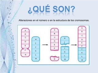 Alteraciones en el número o en la estructura de los cromosomas.
 