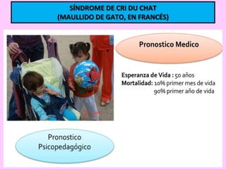 SÍNDROME DE CRI DU CHAT
(MAULLIDO DE GATO, EN FRANCÉS)

 