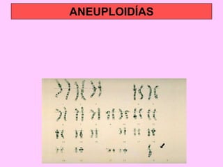 ANEUPLOIDÍAS

 
