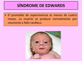 SÍNDROME DE EDWARDS
• El promedio de supervivencia es menos de cuatro
meses. La muerte se produce normalmente por
neumonía o fallo cardíaco.

 