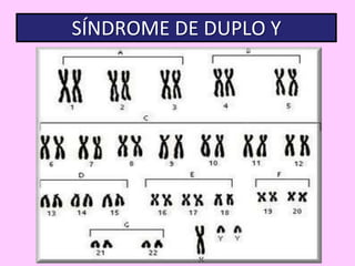 SÍNDROME DE DUPLO Y

 