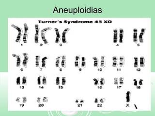 AneuploidiasAneuploidias
 
