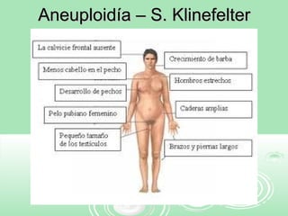 Aneuploidía – S. KlinefelterAneuploidía – S. Klinefelter
 