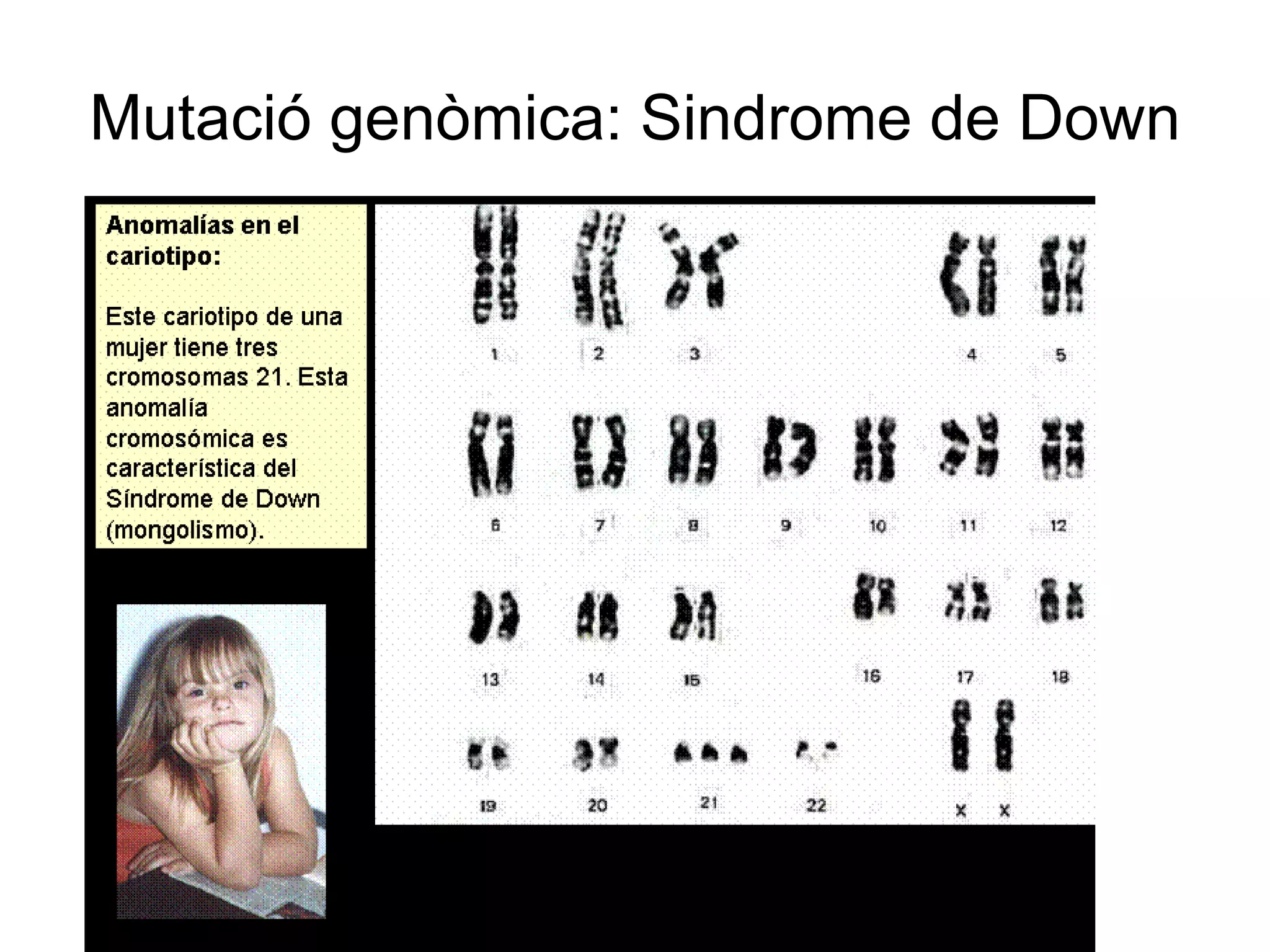 Mutació genòmica: Sindrome de Down 